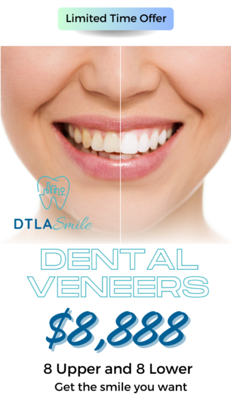 Limited time offer. DTLA Smile. Dental Veneers. 8 Upper and 8 lower. Get the smile you want.